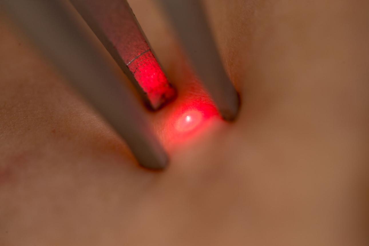 Chirurgie dermatologique — Clinique du Saint-Cœur